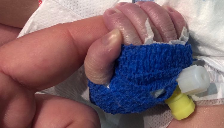 ДВЕ БЕБИЊА СО ТЕШКИ СРЦЕВИ МАНИ ОПЕРИРАНИ ВО „АЏИБАДЕМ СИСТИНА“ ВО ВОНРЕДНИ УСЛОВИ ПОРАДИ КОРОНАВИРУСОТ