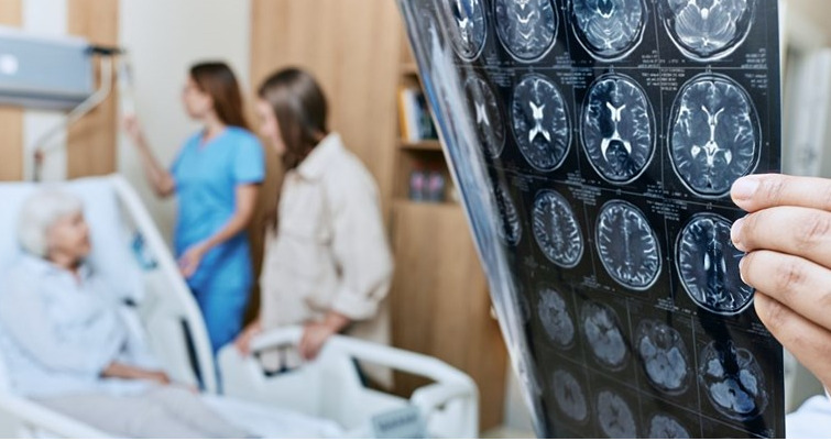 Во Британија ќе биде одобрен лек кој ја забавува Алцхајмеровата болест