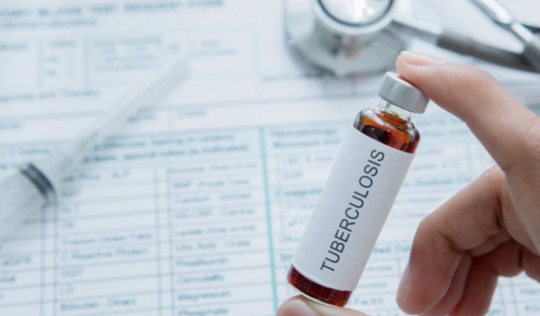 Извештај на СЗО: Осум милиони луѓе во светот страдаат од туберкулоза