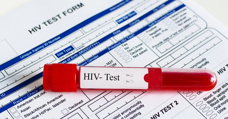 Бесплатно тестирање за ХИВ и сексуално преносливи болести: „Тестни се! Прегледај се бесплатно, доверливо и безбедно“